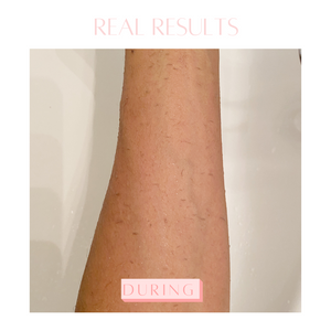 Deep exfoliating glove results- dead skin removal