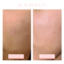 Load image into Gallery viewer, Exfoliating face mitt results