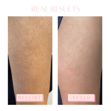 Load image into Gallery viewer, Tan glove- -exfoliating glove- Glow Away Skin 2 Month Use Results- Reduction in Keratosis Pilaris
